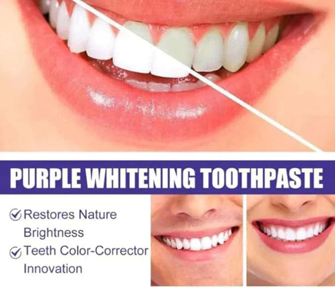 Say cheese with Confidence - Purple Whitening Toothpaste - Buy 1 Get 1 Free