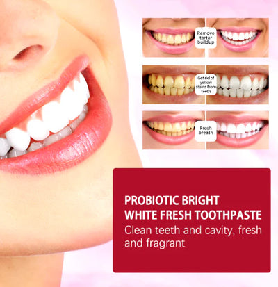 Whitening Toothpaste (120g) - Sp-4