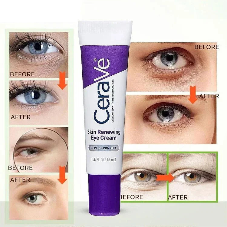 Skin Renewing Eye Cream